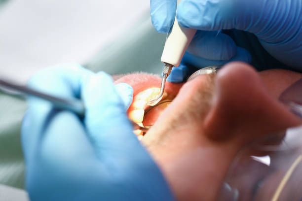Best Broken Tooth Emergency  in Panthersville, GA