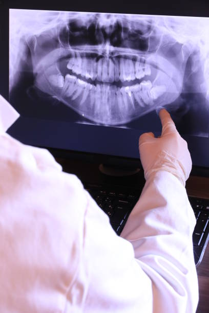 Best Knocked-Out Tooth Emergency  in Panthersville, GA
