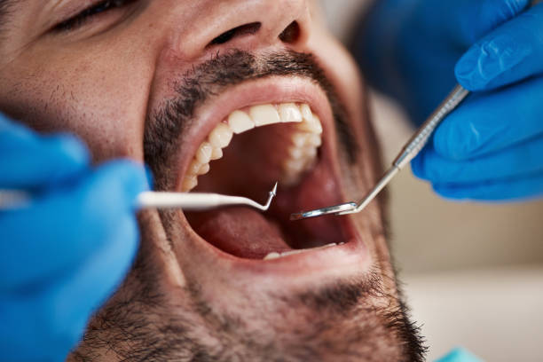Best Knocked-Out Tooth Emergency  in Panthersville, GA