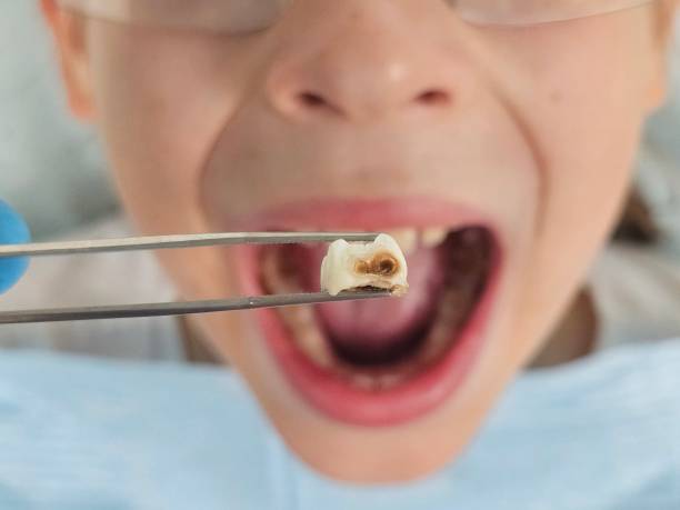Best Dental Emergency Near Me  in Panthersville, GA