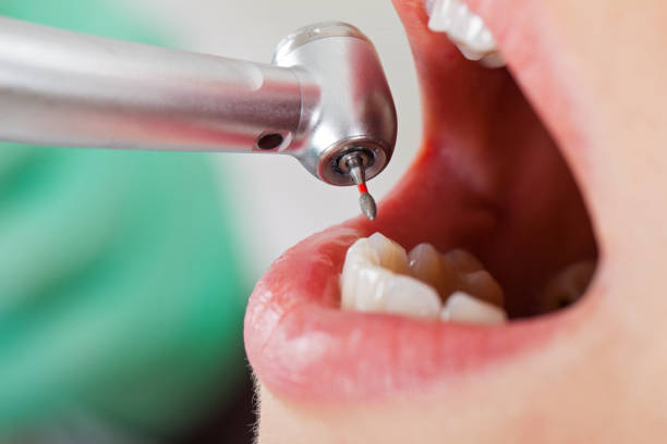 Best Dentist Open on Weekends  in Panthersville, GA